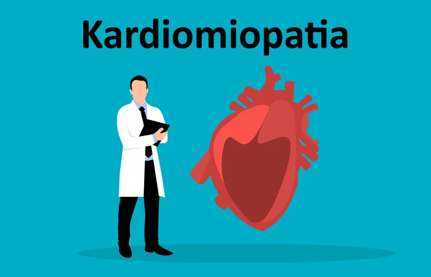 Kardiomiopatia