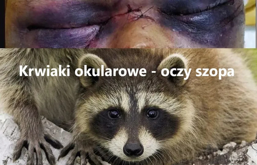 krwiaki okularowe oczy szopa