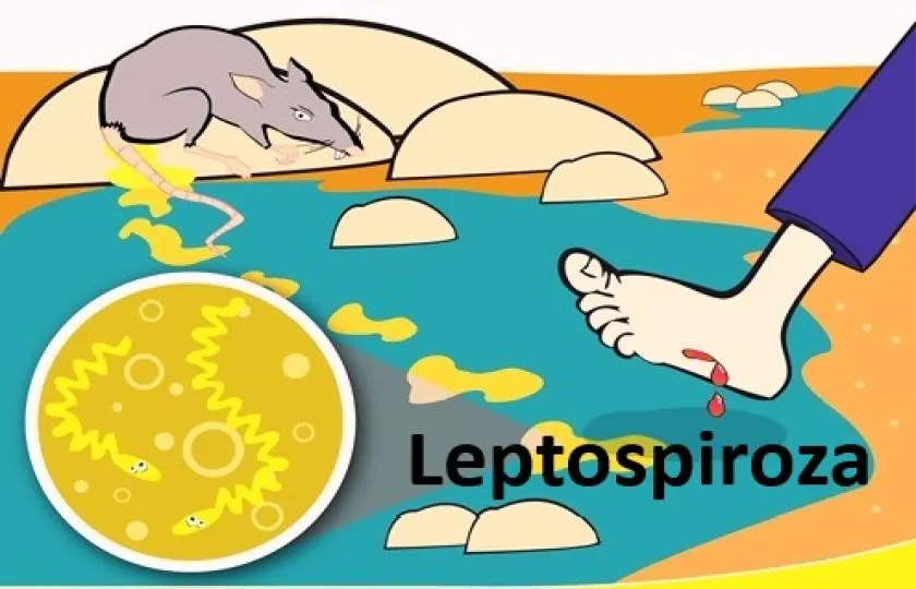 Leptospiroza 