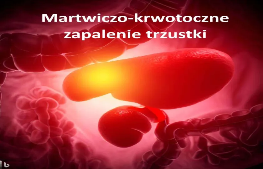 Krwotoczne zapalenie trzustki, martwiczo-krwotoczne zapalenie trzustki