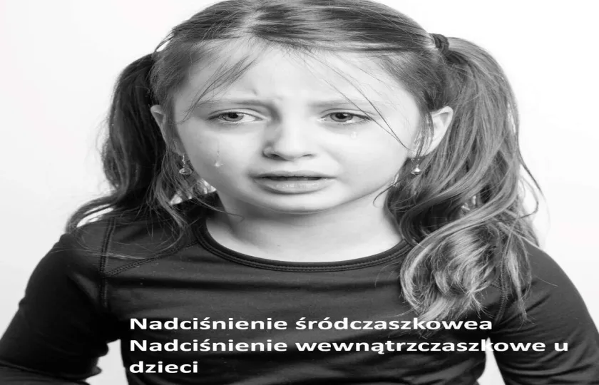 Nadciśnienie śródczaszkowe, nadciśnienie wewnątrzczaszkowe u dzieci