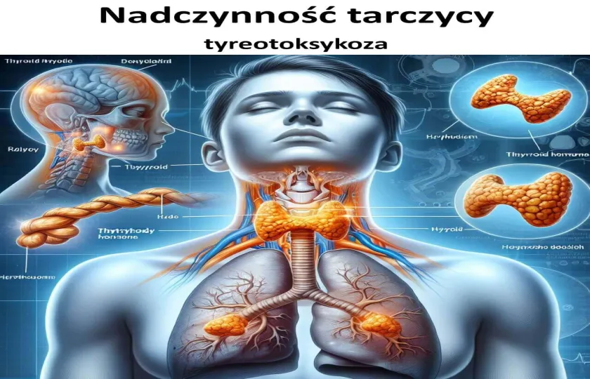 NADCZYNNOŚĆ TARCZYCY, tyreotoksykoza, thyrotoxicosis 