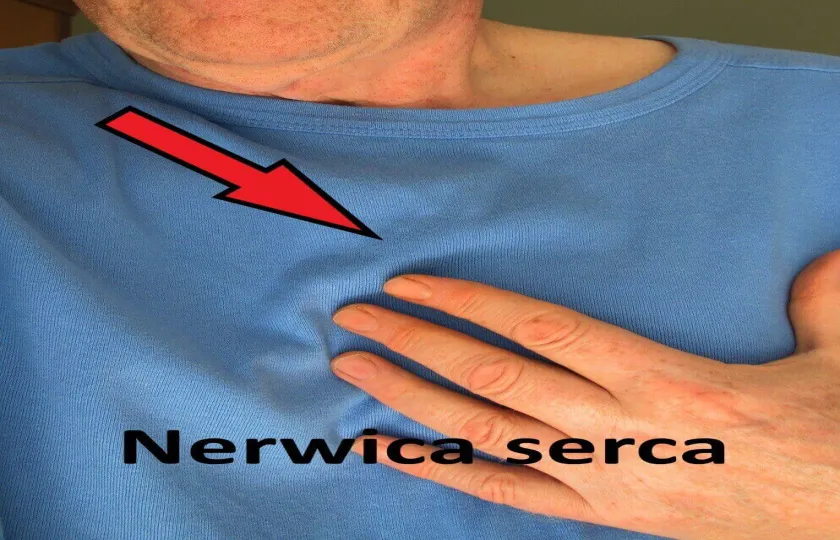 Nerwica serca 
