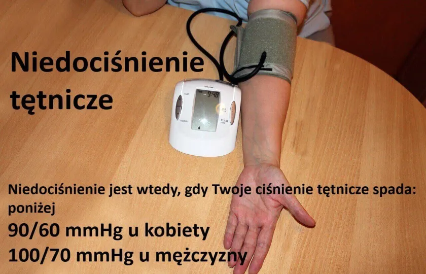 Niedociśnienie tętnicze 