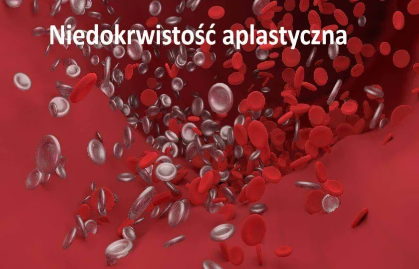 Niedokrwistość aplastyczna, aplazja szpiku, anemia aplastyczna