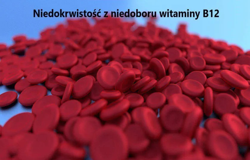 Niedokrwistość z niedoboru witaminy B12
