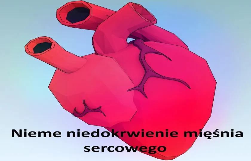 NIEME NIEDOKRWIENIE MIĘŚNIA SERCOWEGO, BEZBOLESNE CICHE niedokrwienie mięśnia sercowego