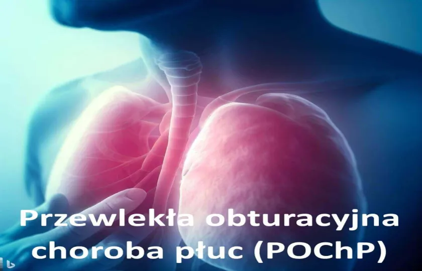 Przewlekła obturacyjna choroba płuc (POChP)