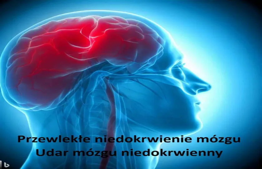 Przewlekłe niedokrwienie mózgu