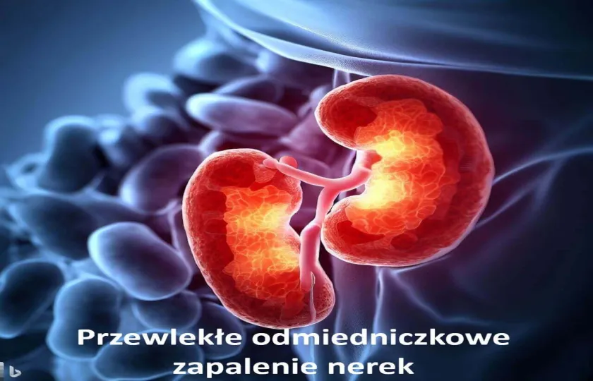 Przewlekłe odmiedniczkowe zapalenie nerek 