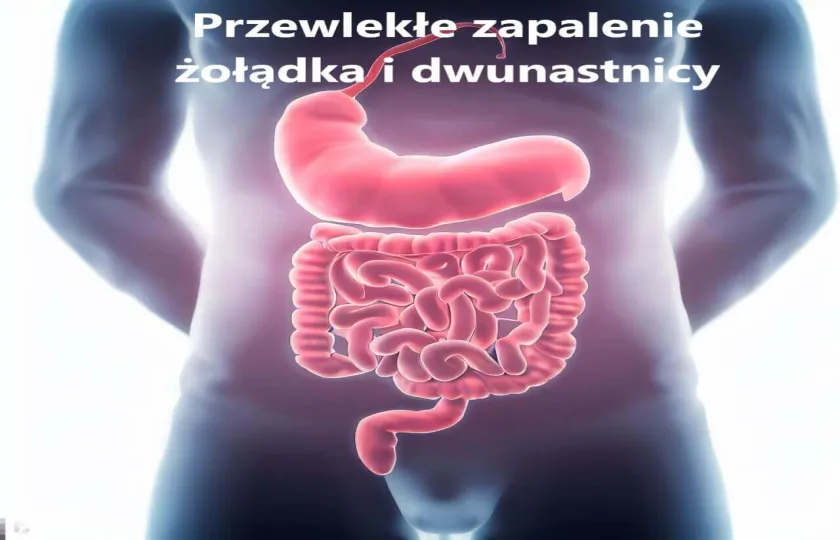 Przewlekłe zapalenie żołądka i dwunastnicy