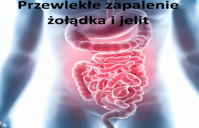 Przewlekłe zapalenie żołądka i jelit