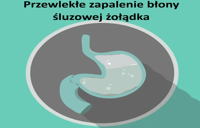 Przewlekłe powierzchowne zapalenie błony śluzowej żołądka