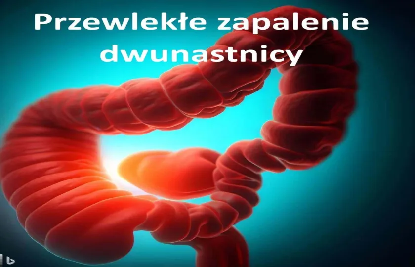 Przewlekłe zapalenie dwunastnicy