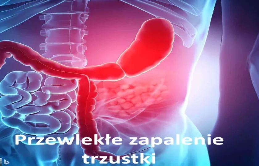 Przewlekłe zapalenie trzustki