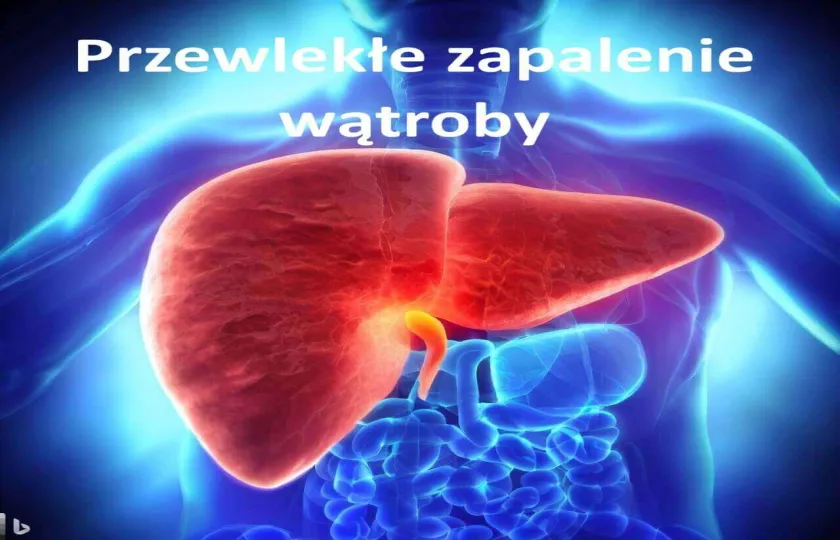 Przewlekłe zapalenie wątroby