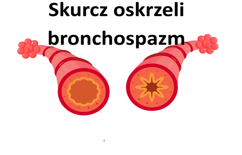 Skurcz oskrzeli, bronchospazm