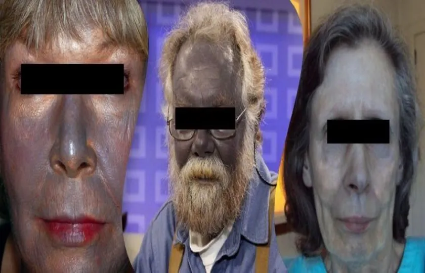 Srebrzyca