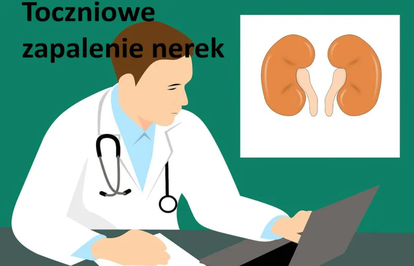 Toczniowe zapalenie nerek, nefropatia toczeniowa 