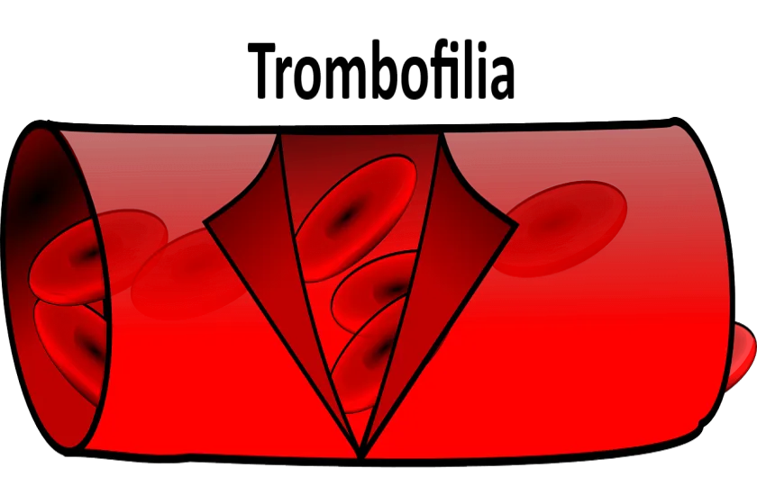 Trombofilia 