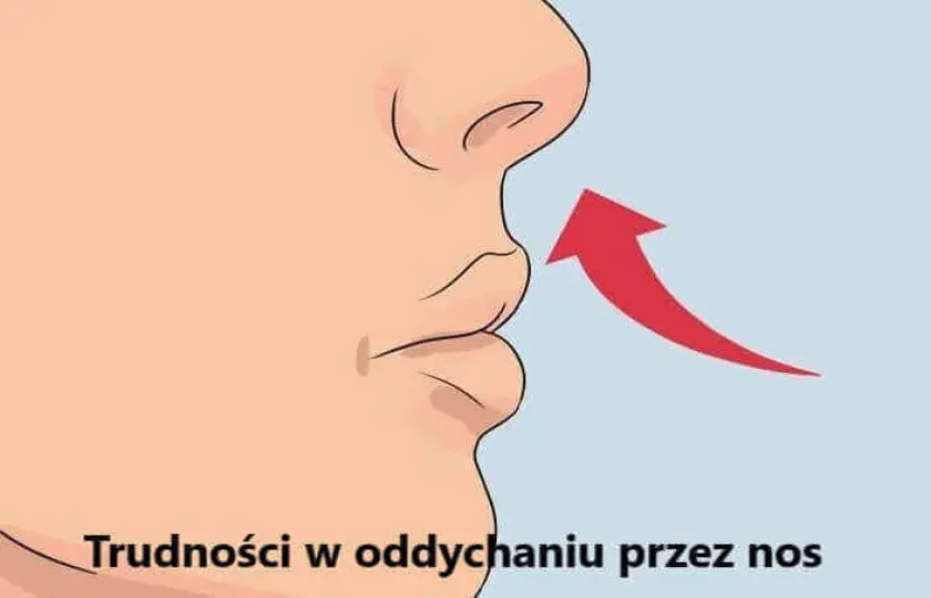 Trudności w oddychaniu przez nos