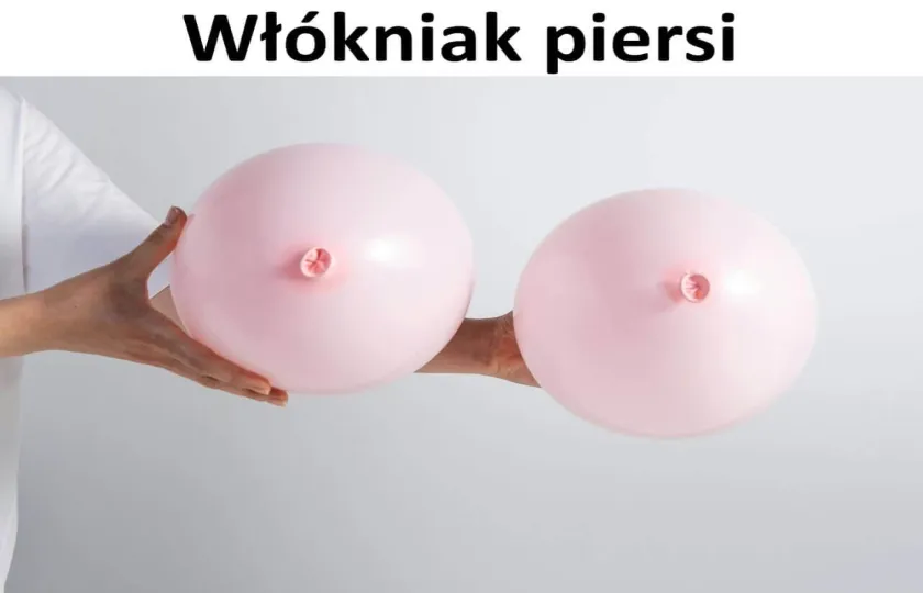 Włókniak piersi, gruczolakowłókniak