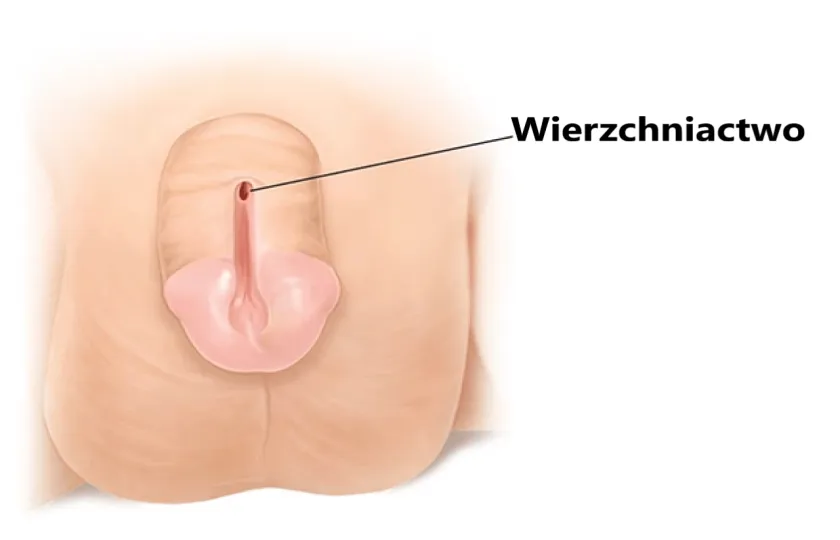 Wierzchniactwo 