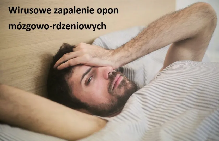 Wirusowe zapalenie opon mózgowo-rdzeniowych objawy diagnostyka leczenie