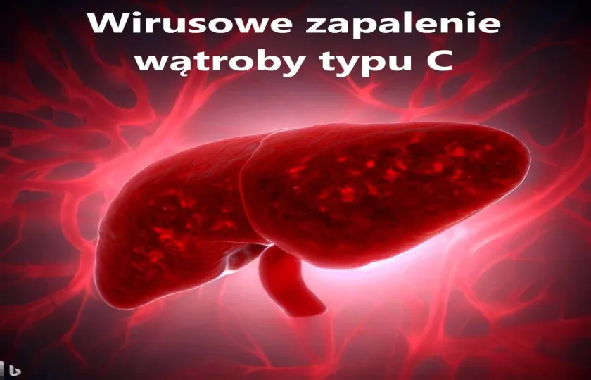 Wirusowe zapalenie wątroby typu C, WZW typu C 