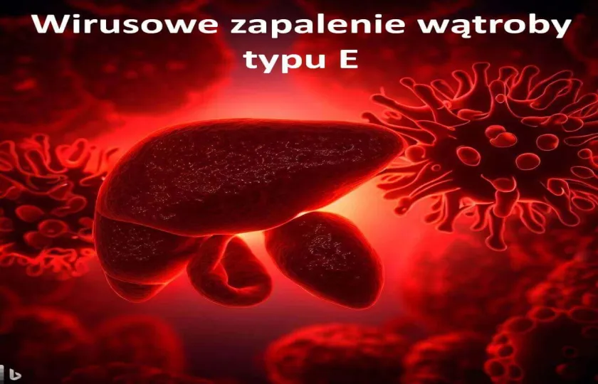 Wirusowe zapalenie wątroby typu E, WZW E 