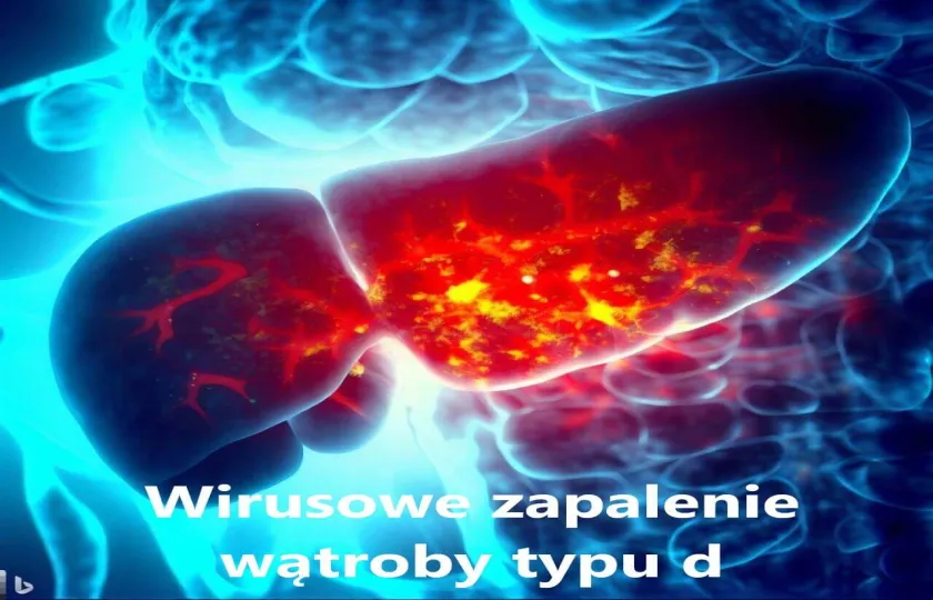 Wirusowe zapalenie wątroby typu d