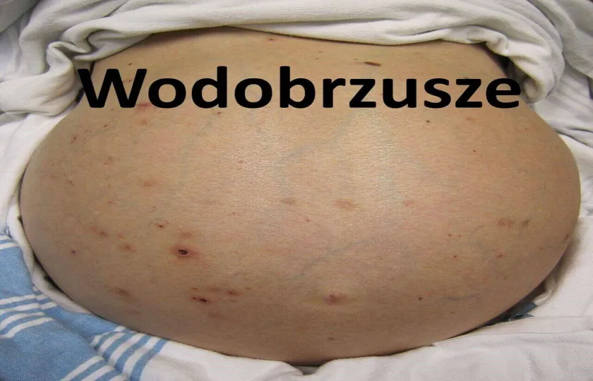 Wodobrzusze 