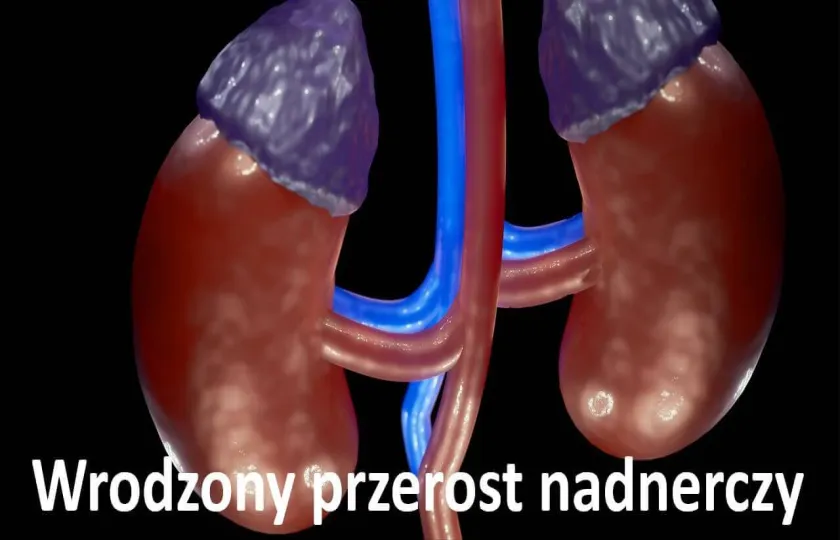 Wrodzony przerost nadnerczy