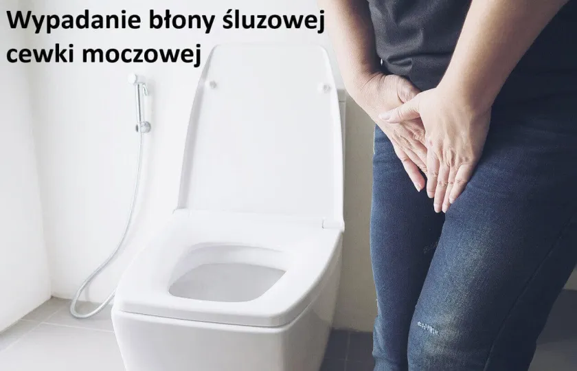 Wypadanie błony śluzowej cewki moczowej
