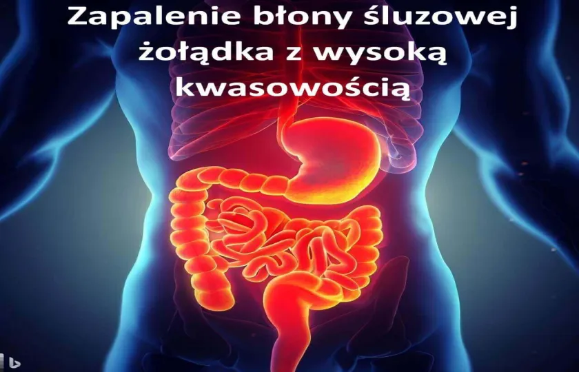 Zapalenie błony śluzowej żołądka z wysoką kwasowością