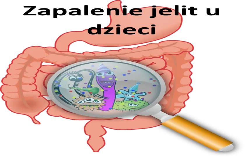 Zapalenie jelit u dzieci