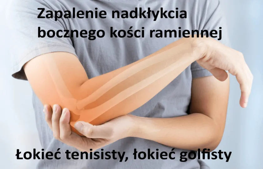 łokieć tenisisty, łokieć golfisty 