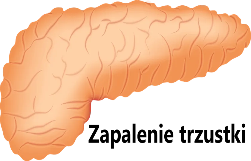 Zapalenie trzustki