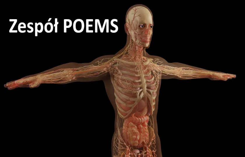 Zespół POEMS, zespół Crow-Fukase, zespół Takatsuki