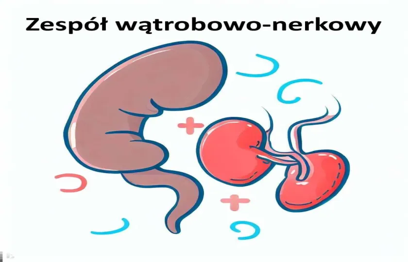 Zespół wątrobowo-nerkowy