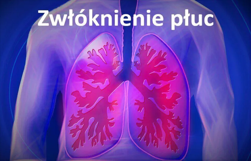 Zwłóknienie płuc 