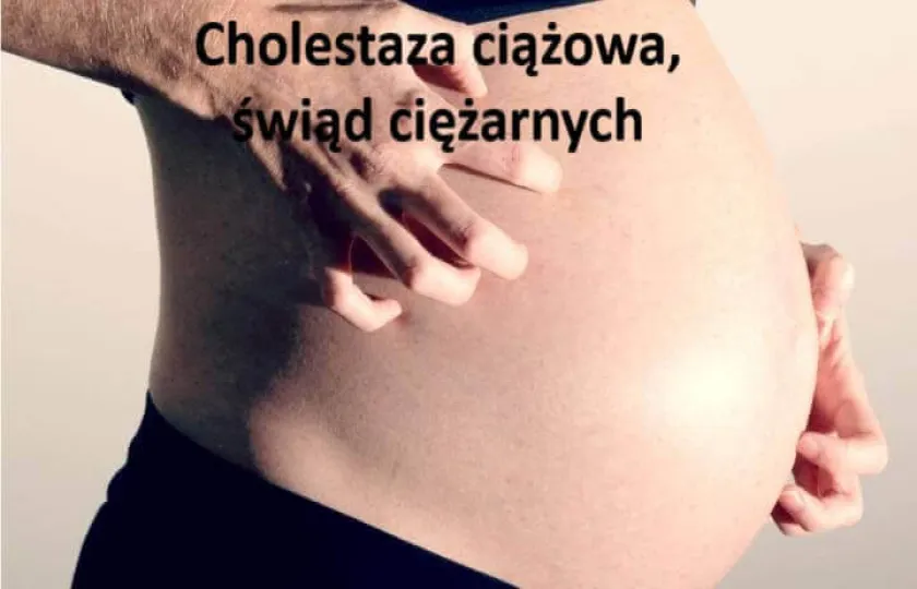 cholestaza ciążowa 