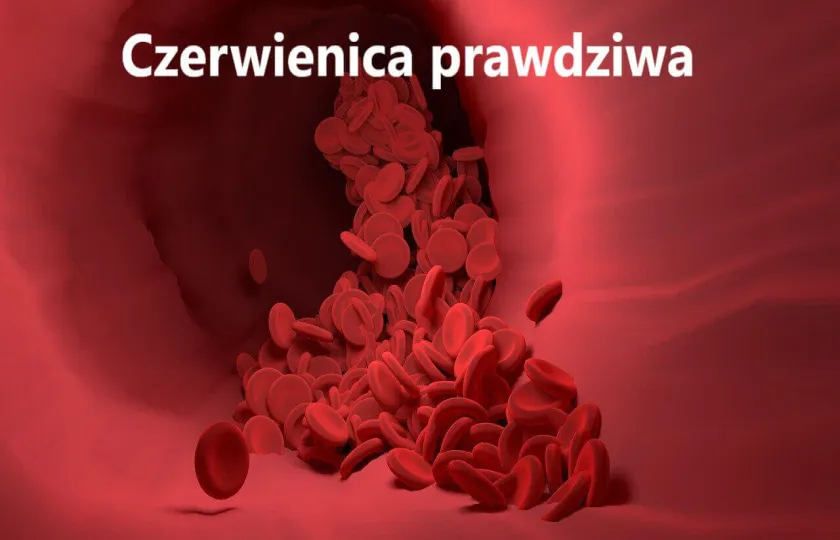 czerwienica prawdziwa