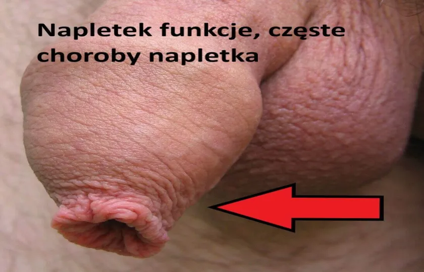 Napletek