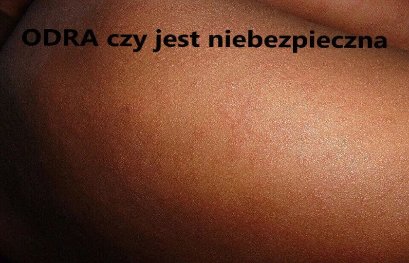 odra czy jest niebezpieczna