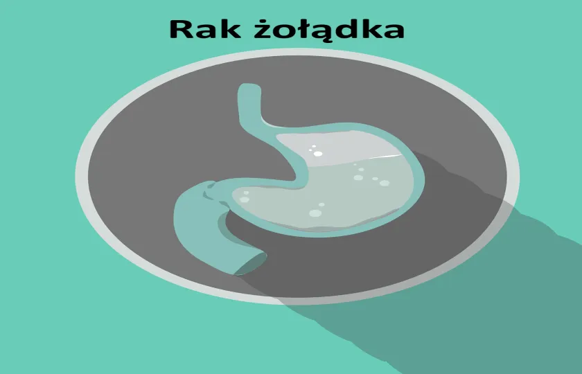 Rak żołądka 