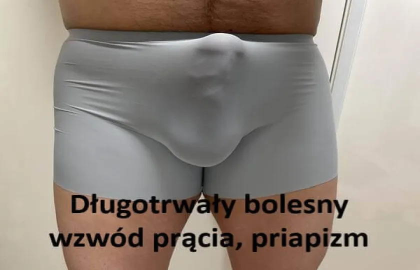  bolesny wzwód prącia, priapizm