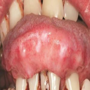Amyloidozy skóry język