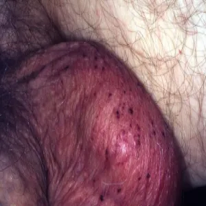 Czarne plamki na mosznie