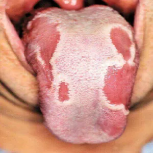 Język geograficzny u dorosłych